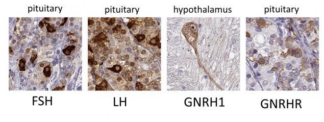 pituitary blogpost_2.jpg