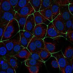 CLDN3 in MCF-7 cells.jpg