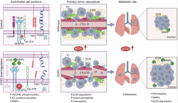 CD93_metastasis.PNG