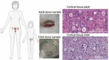 interfollicular_heterogeneity_240904.PNG